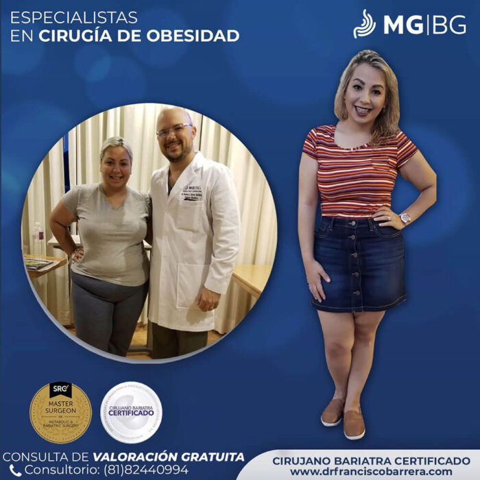 Antes y Después, Cirujano Bariatra, Bariatras en Monterrey, Bariátrico, Cirugía bariátrica, Doctor bariatra, Cirujano bariatrico, costo de cirugia bariatrica en monterrey, cirugias bariatricas en mexico, cirugia bariatrica mexico, cirujano bariatra en monterrey, cirujanos bariatras certificados en monterrey, cirugia bariatrica costo, costo de operacion bariatrica, costo de cirugia bariatrica, financiamiento cirugia bariatrica, financiamiento para cirugia bariatrica, cirugia bariatrica precios. bariatra precio, precio de cirugia bariatrica, precio de operacion bariatrica