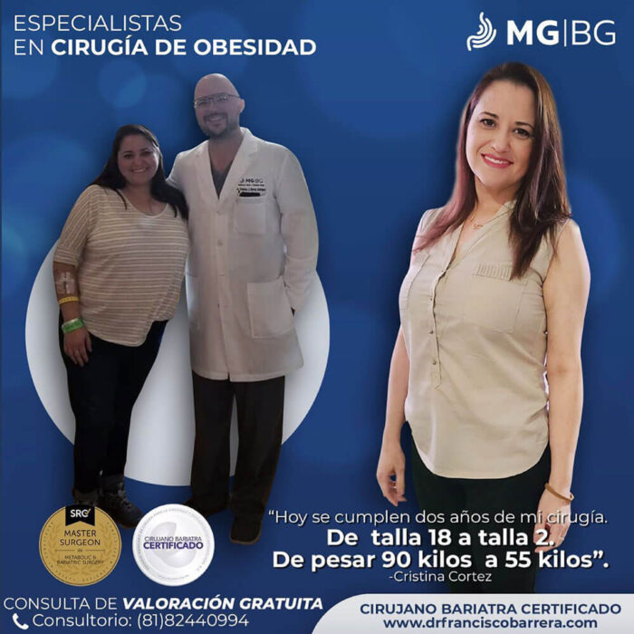 Antes y Después, Cirujano Bariatra, Bariatras en Monterrey, Bariátrico, Cirugía bariátrica, Doctor bariatra, Cirujano bariatrico, costo de cirugia bariatrica en monterrey, cirugias bariatricas en mexico, cirugia bariatrica mexico, cirujano bariatra en monterrey, cirujanos bariatras certificados en monterrey, cirugia bariatrica costo, costo de operacion bariatrica, costo de cirugia bariatrica, financiamiento cirugia bariatrica, financiamiento para cirugia bariatrica, cirugia bariatrica precios. bariatra precio, precio de cirugia bariatrica, precio de operacion bariatrica