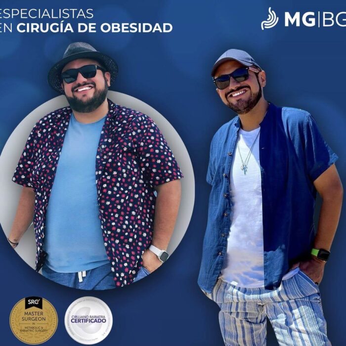Antes y Después, Cirujano Bariatra, Bariatras en Monterrey, Bariátrico
