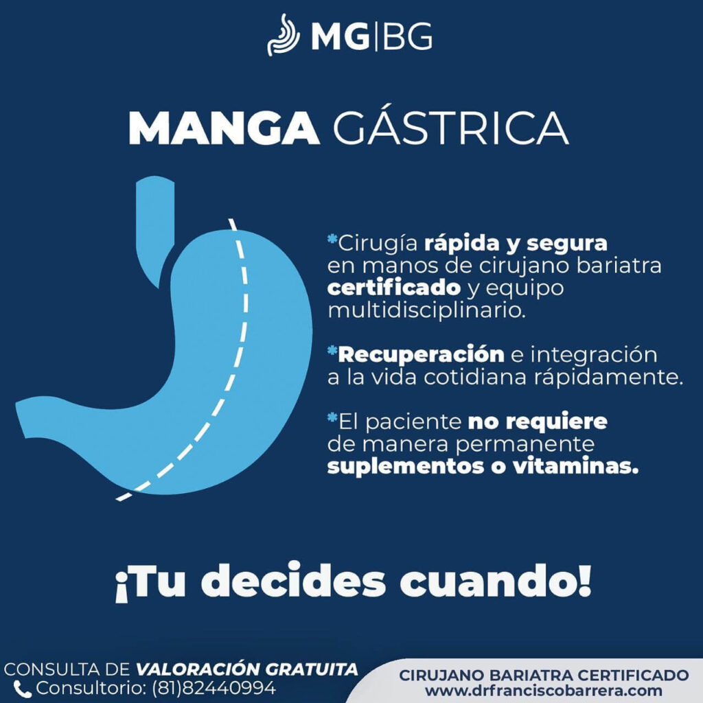 Manga gástrica, Manga gástrica precio, precio manga gástrica, Cuanto cuesta una manga gástrica, Manga gástrica costos, Manga gástrica que es, Que es manga gástrica, Que es una manga gástrica, Cirugía manga gástrica, Cirugía de manga gástrica, Operación manga gástrica, Manga gástrica Monterrey, cirugia de manga gastrica en mexico, cuanto cuesta la manga gastrica en mexico, precio de manga gastrica en mexico, costo de la manga gastrica en mexico, cirugia para bajar de peso, cirugia de obesidad, operacion para adelgazar, operacion de estomago, reduccion de estomago, operaciones para bajar de peso, perdida de peso.